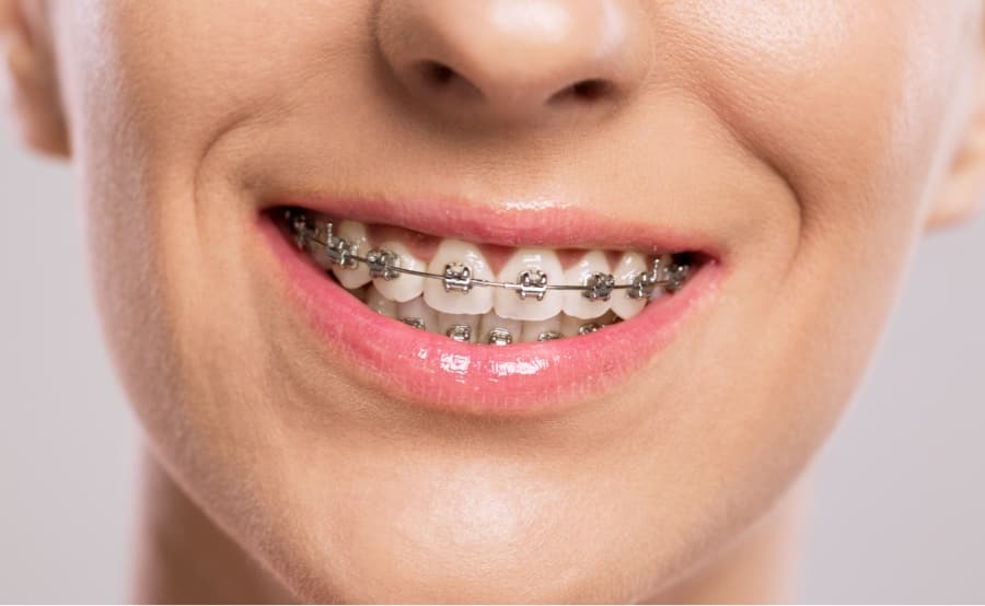metal braces on patient